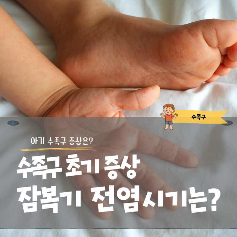 수족구 초기 증상부터 잠복기 전염 시기까지 정리