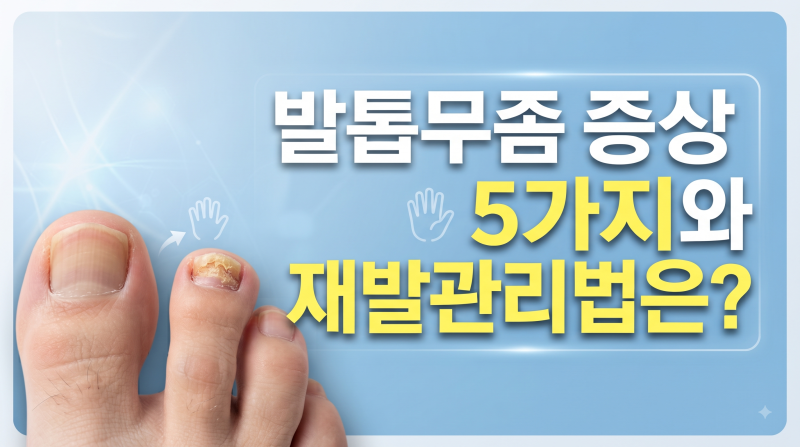 발톱무좀 증상 5가지, 좋은 음식 4가지와 재발 관리법