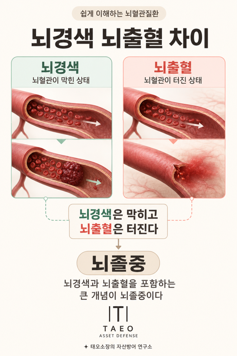 뇌졸중 초기증상과 뇌경색 뇌출혈 차이, 뇌혈관질환 보험 보장범위 총정리