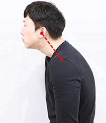 일자목 기준 각도와 진단 방법, 베개 높이와 회복 가능성까지