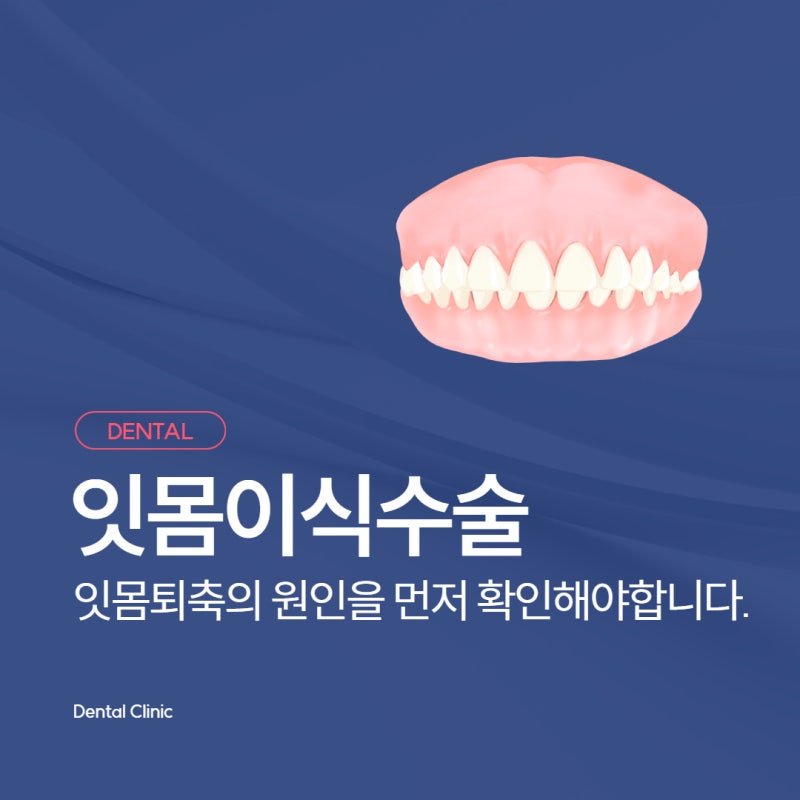잇몸이식수술, 잇몸퇴축의 원인을 먼저 확인해야 합니다