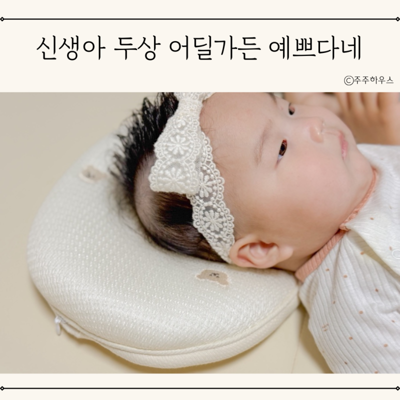 신생아 두상베개 사용시기 엔젤앤비 아기 두상 관리