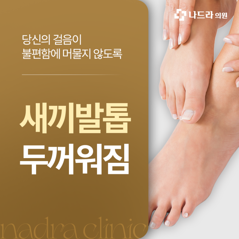 새끼 발톱 두꺼워짐, 압박과 발톱무좀은 어떻게 구분할까요?