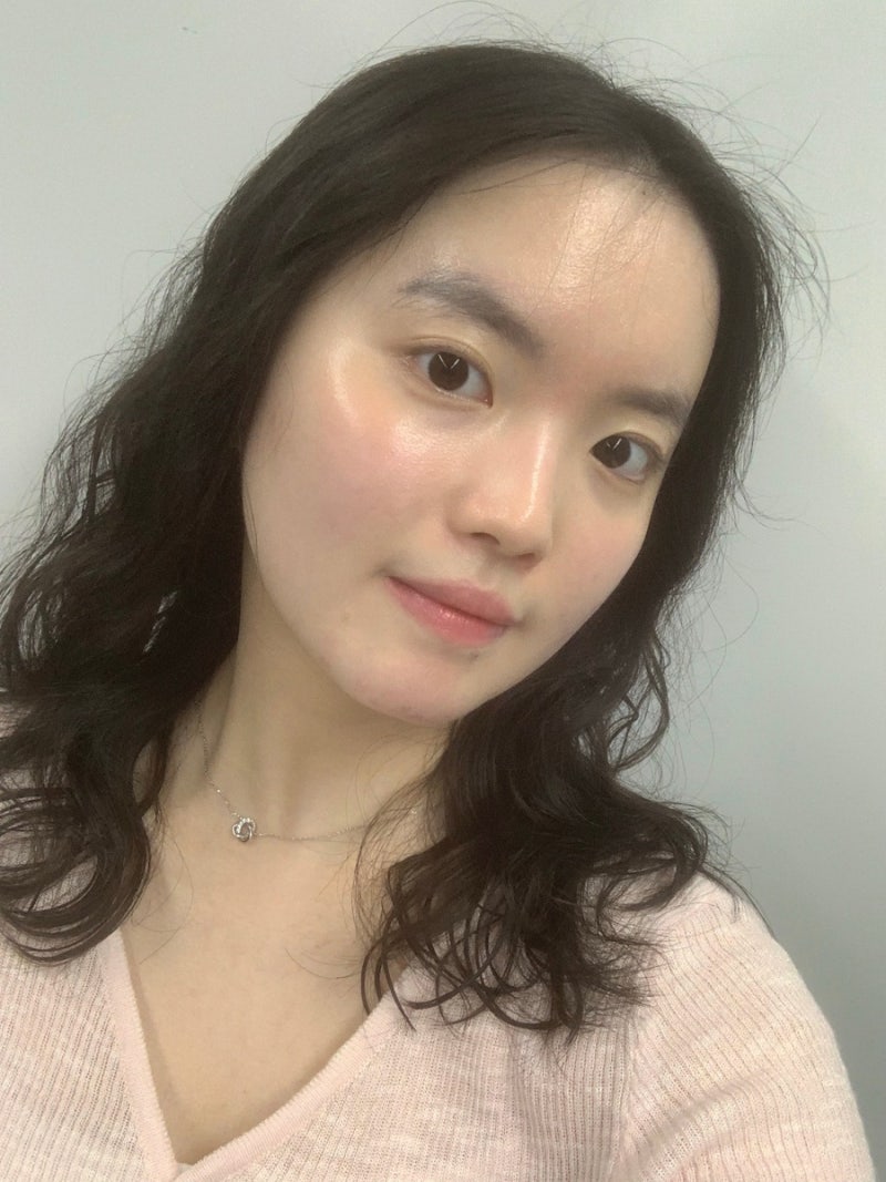 측두근보톡스 : 관자놀이 정리 및 두통 개선 후기