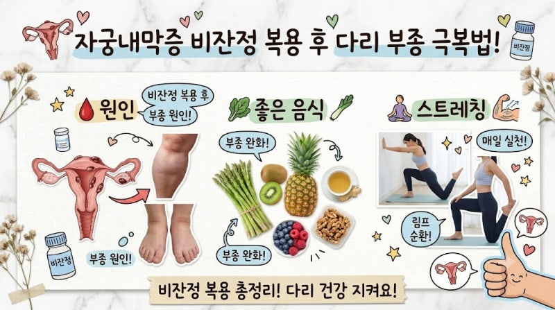 자궁내막증 비잔정 복용 후 다리 부종 극복법! 원인부터 좋은 음식·스트레칭 총정리