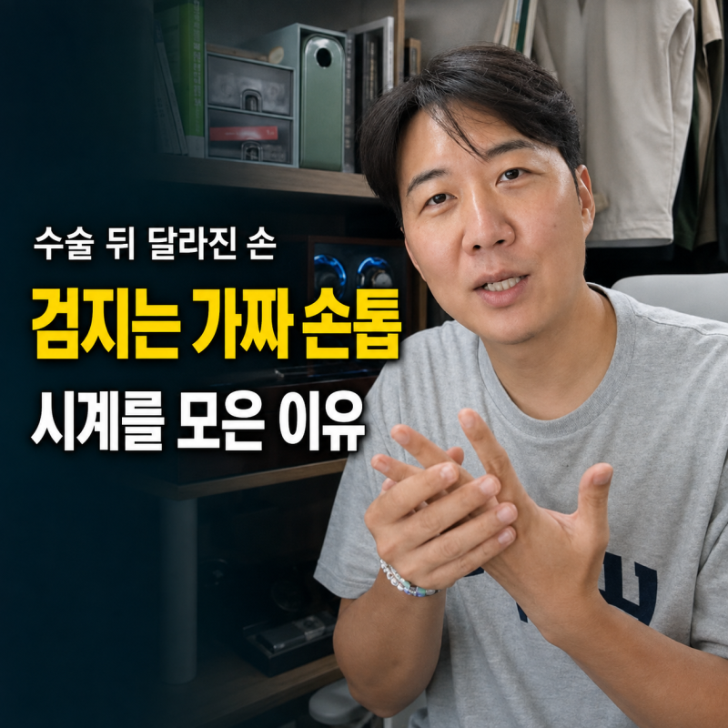 도경완, 급성 골수염 수술 후 검지는 가짜 손톱…시계 수집 시작한 이유