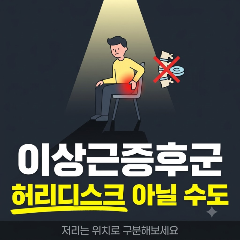 이상근증후군, 허리디스크로 착각하기 쉬운 엉덩이 통증 구분법