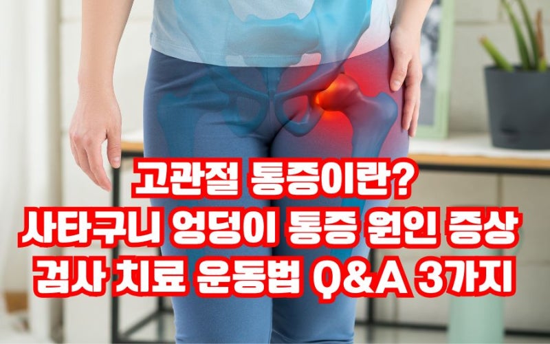 고관절 통증 사타구니 엉덩이 통증 원인 증상 검사 치료 운동법 Q&A 3가지