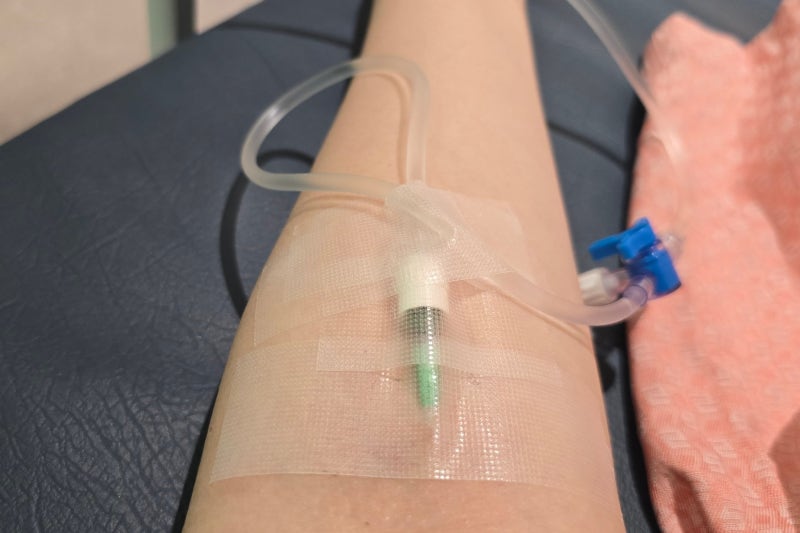 복부CT 조영제 금식시간, 이 검사로 알 수 있는 것