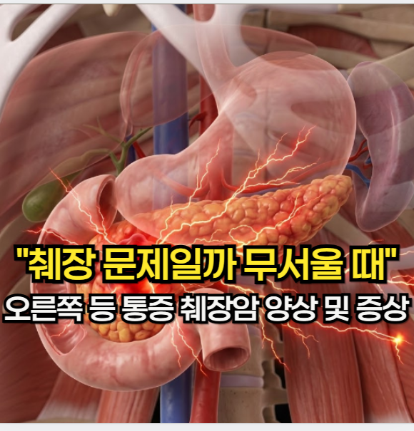 오른쪽 등 통증 "소화 안 되고 아파 무서울 때" 오른쪽 등 통증 췌장암 양상 및 증상