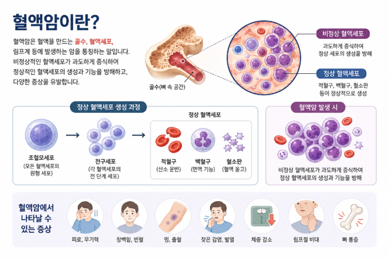 (암) 혈액암 - 이유없이 멍이 잘 들어서 찾아 본 혈액암, 혈액암이란?, 혈액암의 종류, 증상, ....