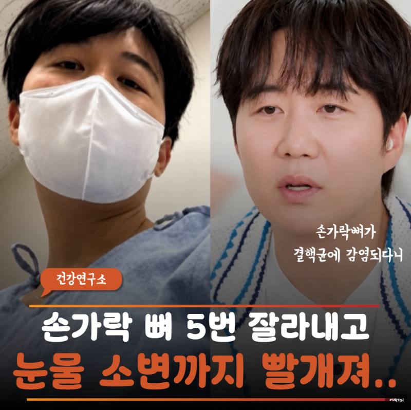 "또 장윤정한테 빌붙는다?" 도경완 손가락 뼈 5번 깎아내고 인조손톱, 손톱 밑 작은 점이 부른....