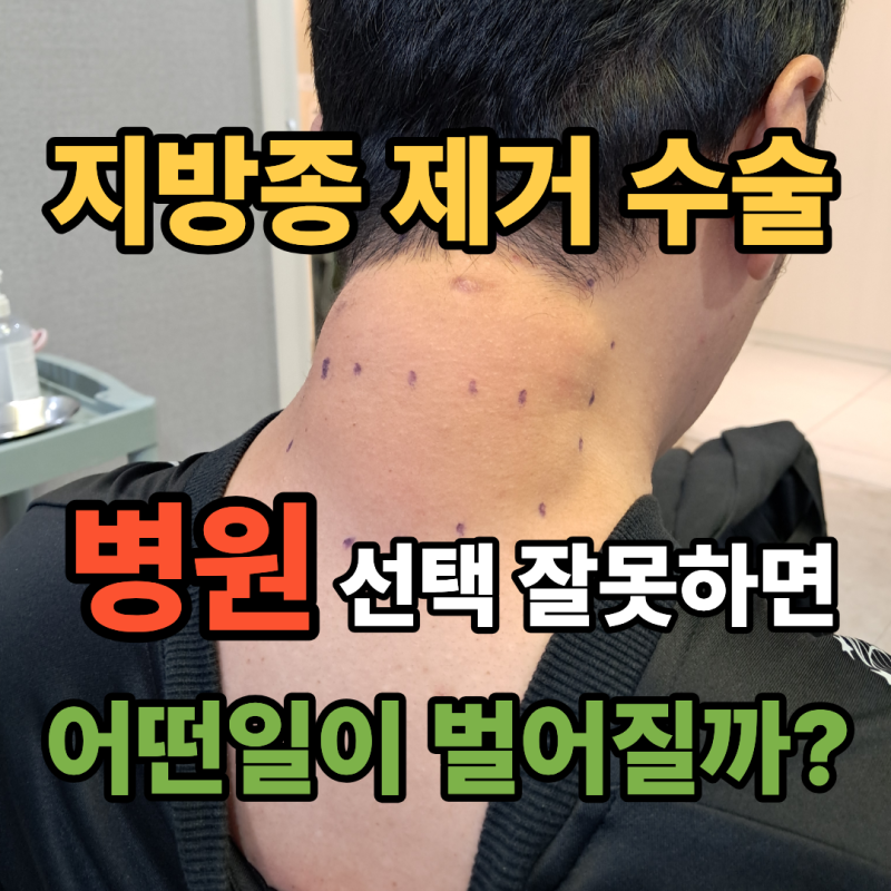 지방종 제거수술 병원 선택 잘못하면 어떤 일이 벌어질까?