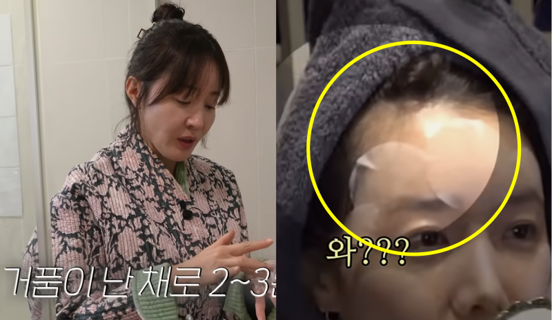 엄지원 채정안 헤어라인, 두피케어관리법 40대 여자연예인