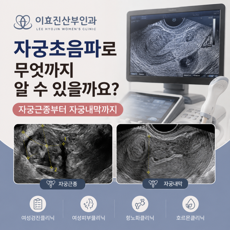자궁초음파로 무엇까지 알 수 있을까요? 자궁근종부터 자궁내막까지