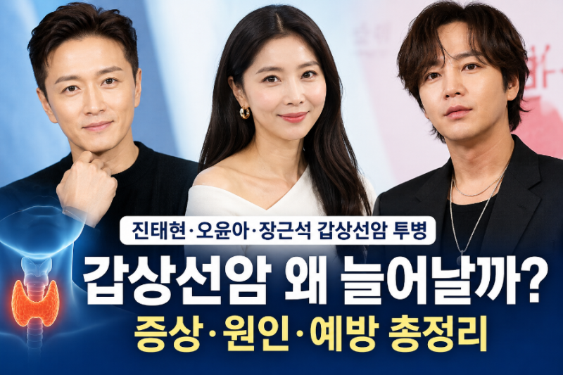 진태현·오윤아·장근석도 겪은 갑상선암, 왜 이렇게 흔할까? 스트레스가 원인일까