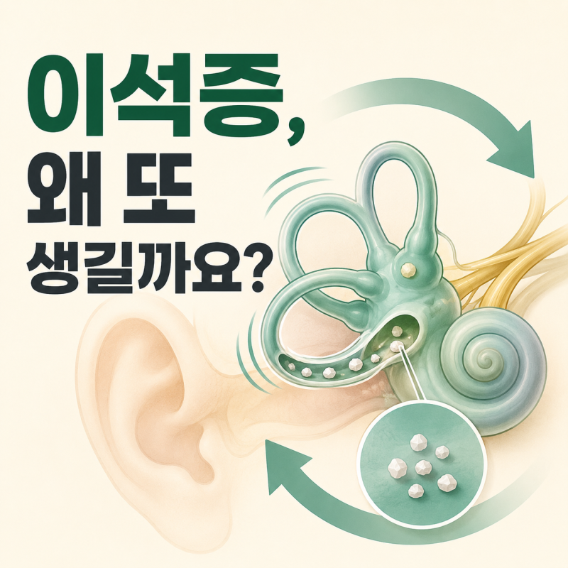이석증은 왜 자꾸 재발할까요? 재발이 잦을 때 확인할 것들
