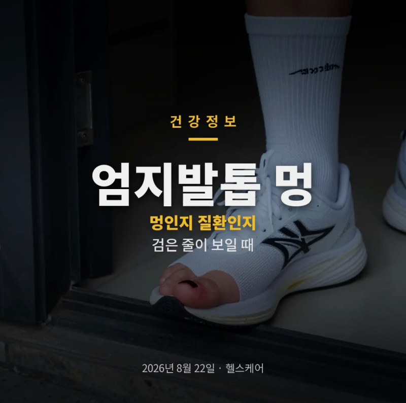 엄지발톱 멍 발톱 밑 피멍과 발톱 흑색종 구분이 헷갈릴 때