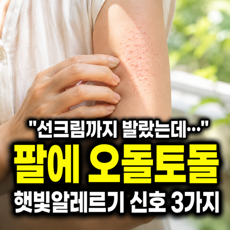 “선크림까지 발랐는데…” 팔에 오돌토돌 올라온 햇빛알레르기 신호 3가지