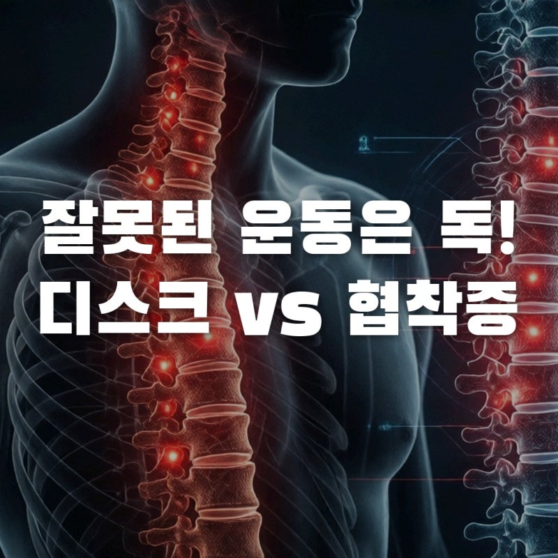 허리디스크협착증차이, 잘못된 운동이 독이 되는 이유!