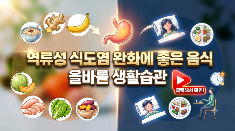 역류성 식도염 증상 완화에 좋은 꼭 먹어야 할 음식과 올바른 생활습관 총정리