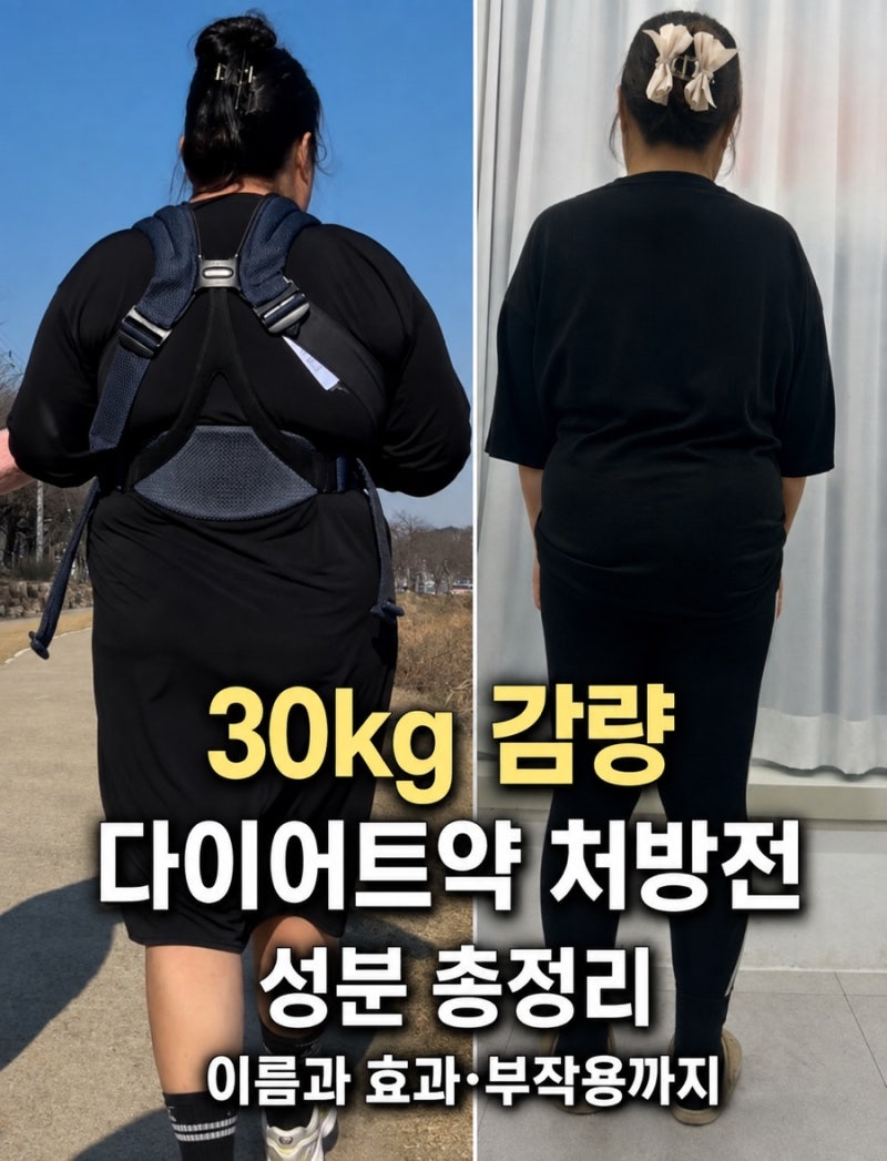 30kg 감량 다이어트약 처방전 성분 총정리, 이름과 효과·부작용까지