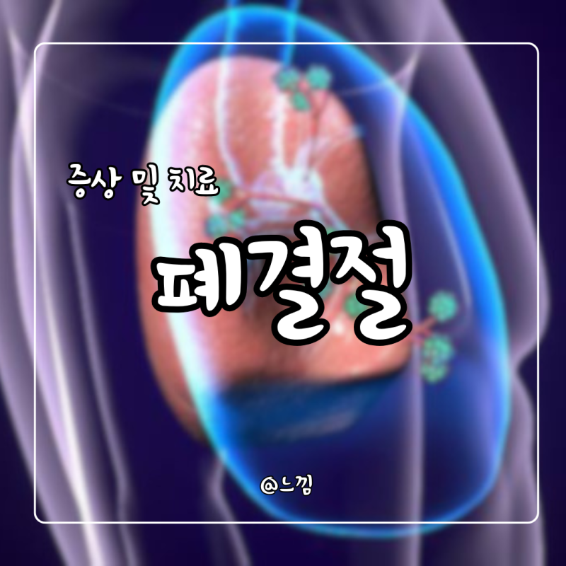 폐결절 증상 원인 치료 고립성 폐결절