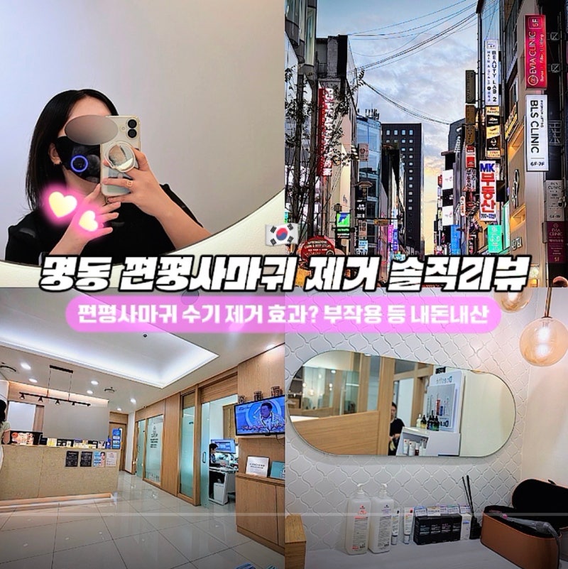 명동 얼굴 편평사마귀 수기 제거 효과? 편평사마귀 성지라는 을지로 한의원 내돈내산 솔직리....