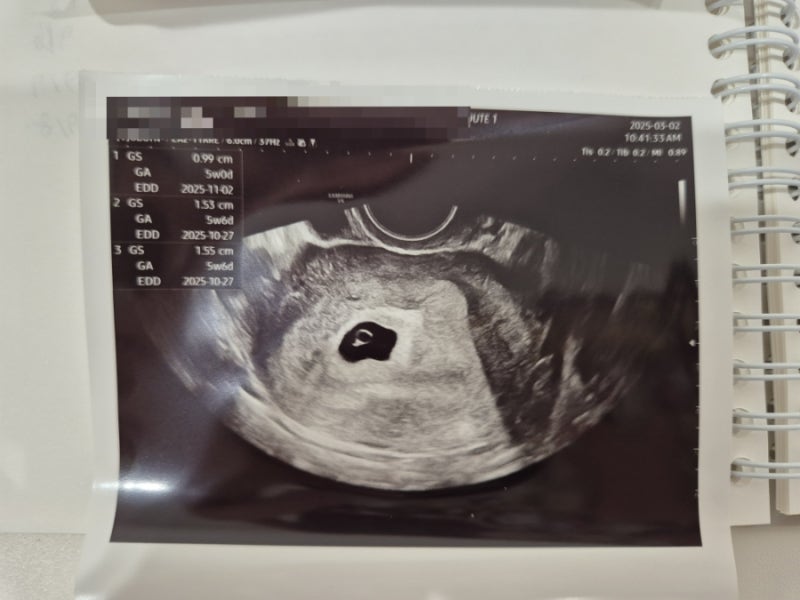루트여성의원 이미경원장님 자연분만 후기(계류유산, 조산기 입원, 유도분만, 식사, 퇴원, 준....