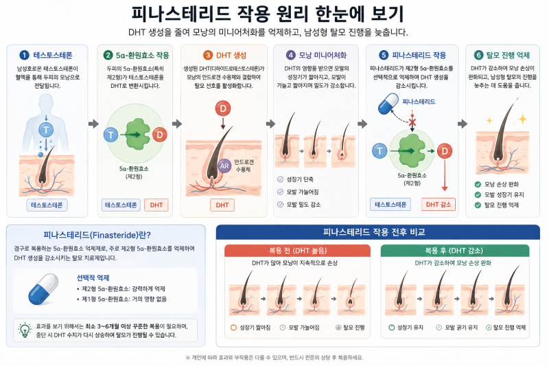 피나스테리드 복용 후기｜직접 먹어보며 알게 된 효과·부작용·주의사항
