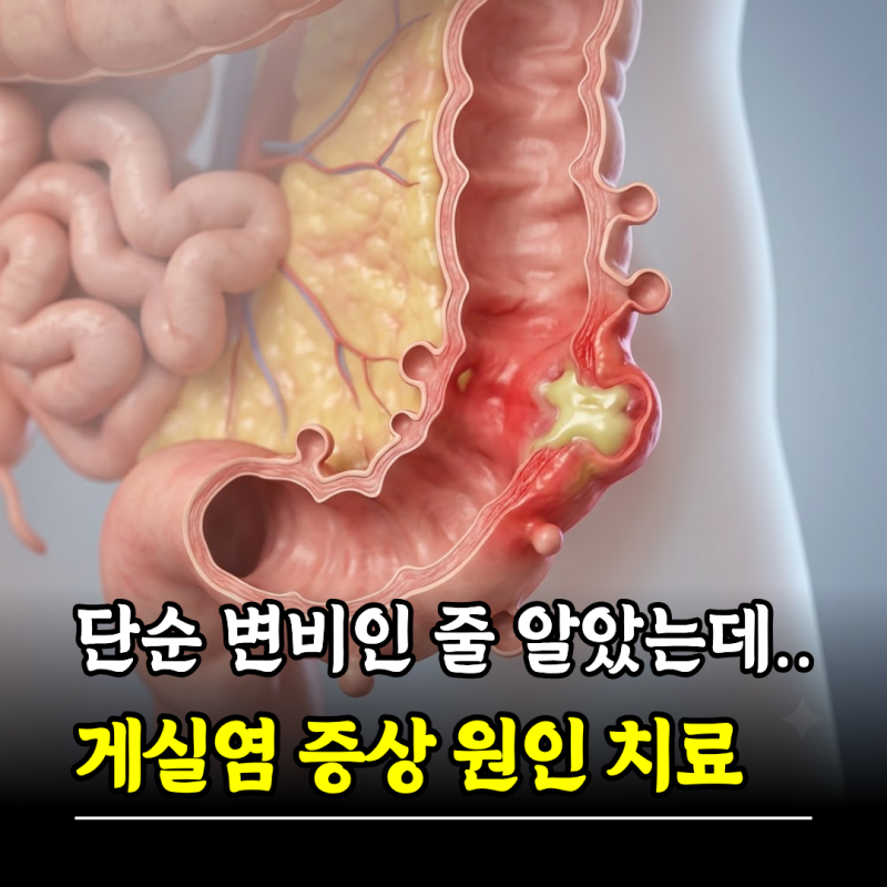 "단순 변비인 줄 알았는데.." 게실염 증상 원인 치료