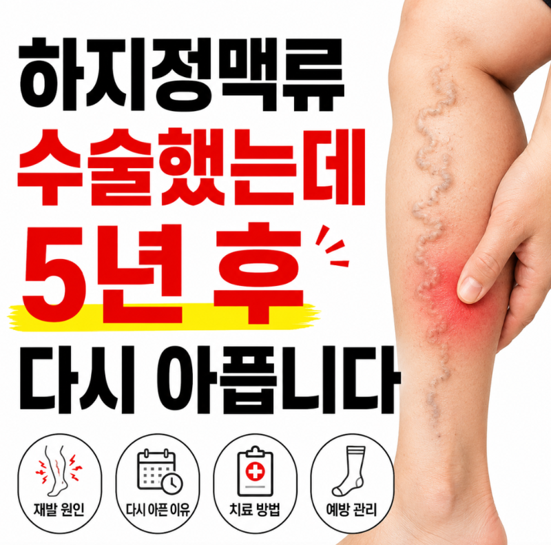 하지정맥류 수술했는데 5년 후 다시 아픕니다