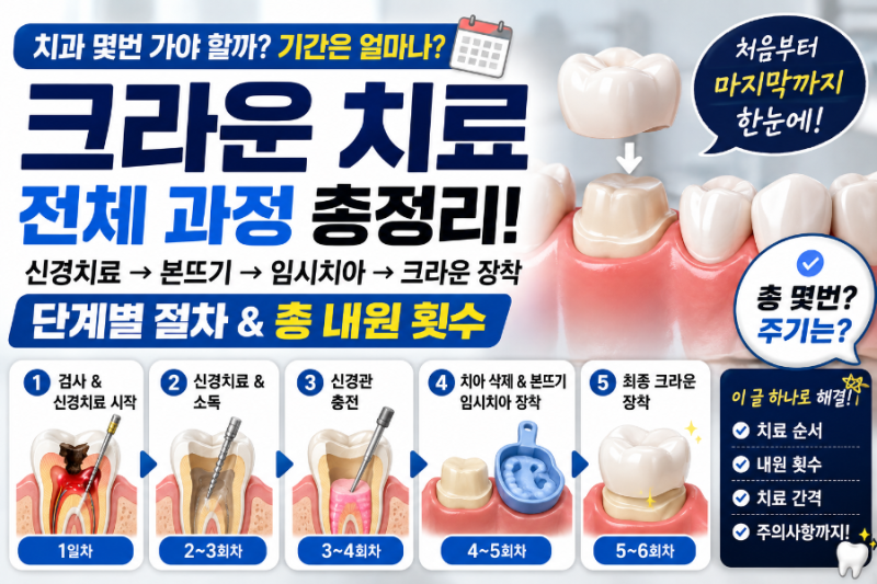 크라운 치료 과정 총정리! 신경치료부터 본뜨기·임시치아·크라운까지 치과 몇 번 가야 할까....