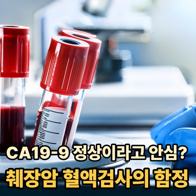 “CA19-9 정상이라고 안심?”...췌장암 혈액검사의 함정