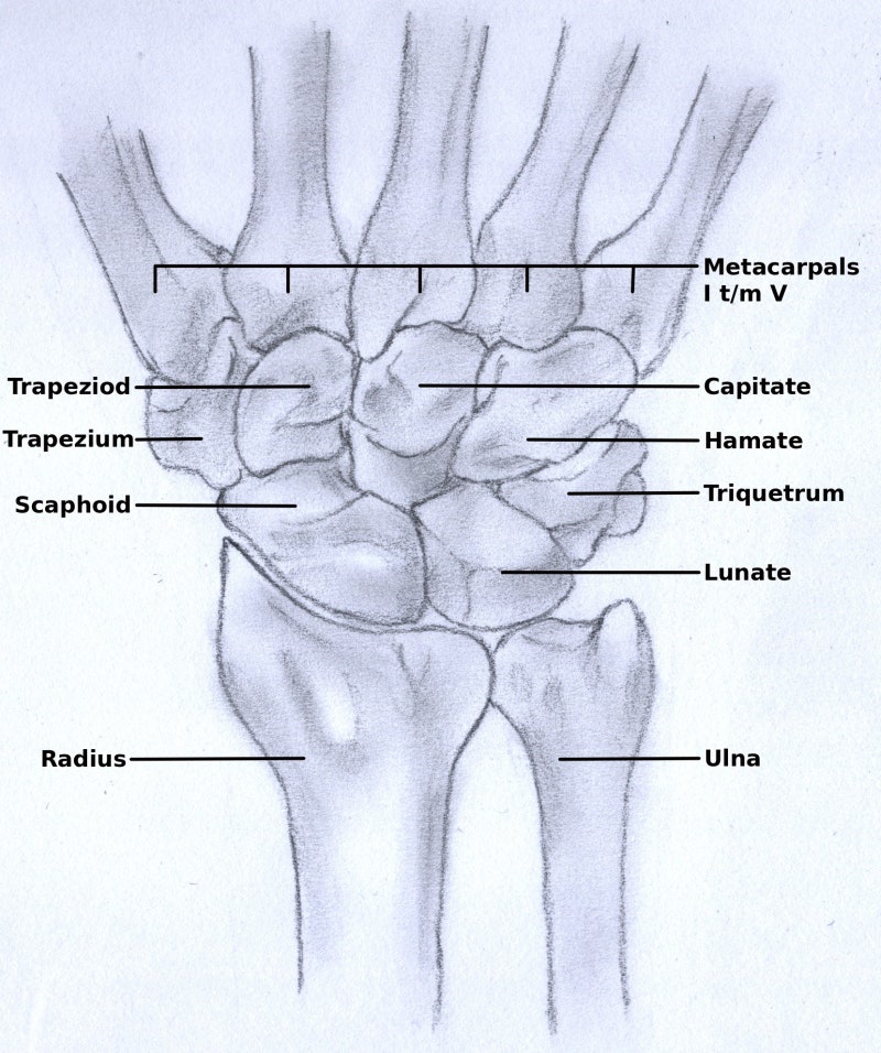Radius/Unla flexion(deviation)