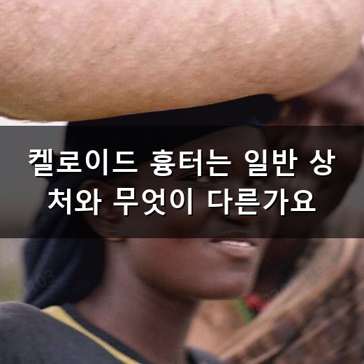 켈로이드 흉터 남는 이유와 관리 방법 정리