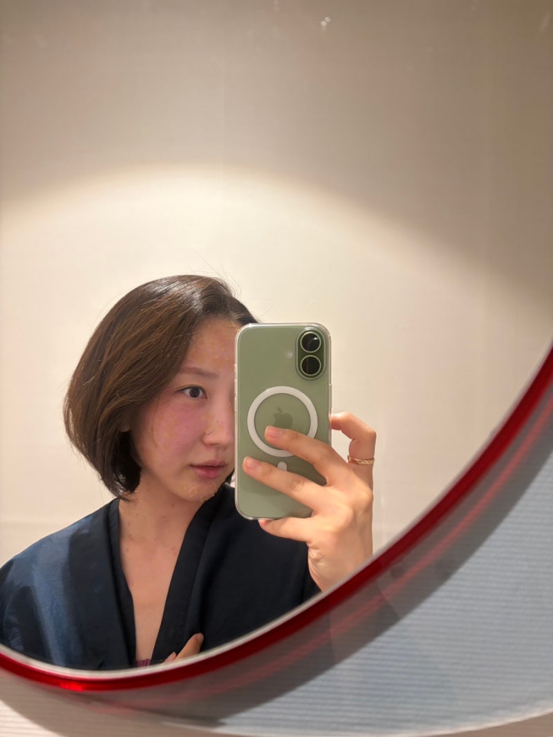 [수서역 피부과] 얼굴과 목 잡티 모두 제거한 날/CO2레이저,루비레이저 당일 후기