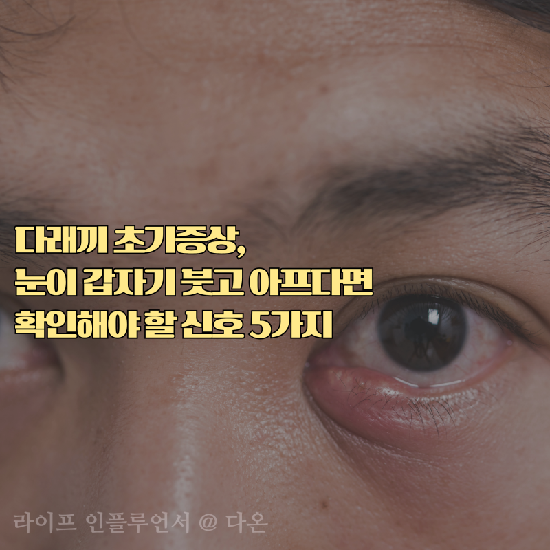 다래끼 초기증상, 눈이 갑자기 붓고 아프다면 확인해야 할 신호 5가지