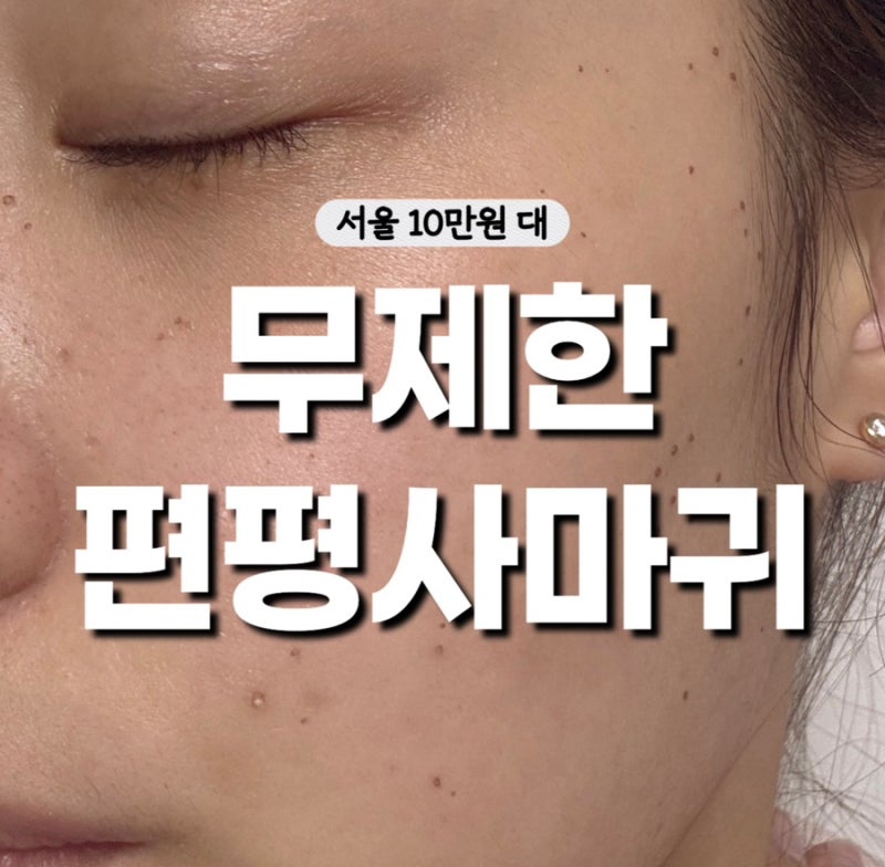 서울 편평사마귀 성지 얼굴 전체 무제한 제거 10만원대 - 일주일 변화 후기