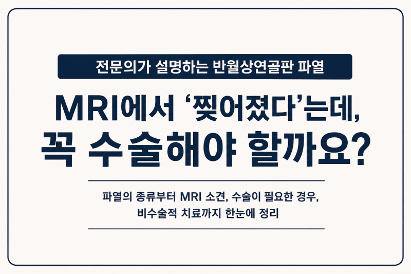 4-2. 반월상연골판 파열. MRI에서 ‘찢어졌다’는데, 꼭 수술해야 할까요?