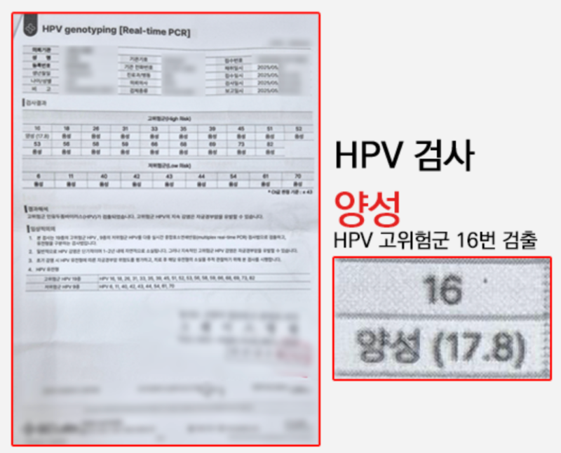 자궁경부암과 자궁경부이형성증 증상의 차이, 치료 방법과 자연치유 가능성은?