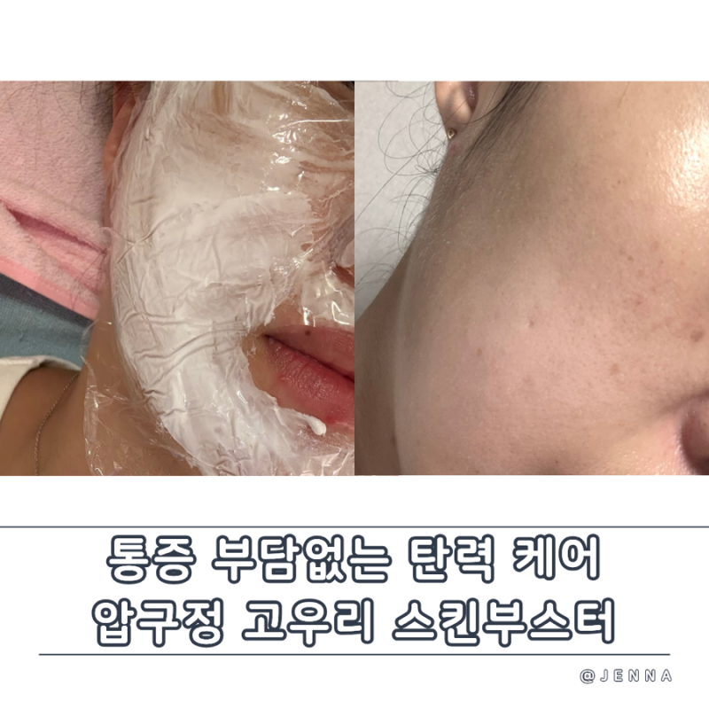 압구정 고우리 스킨부스터 - 통증 줄인 더마샤인 7cc 솔직 후기 및 가격 정보