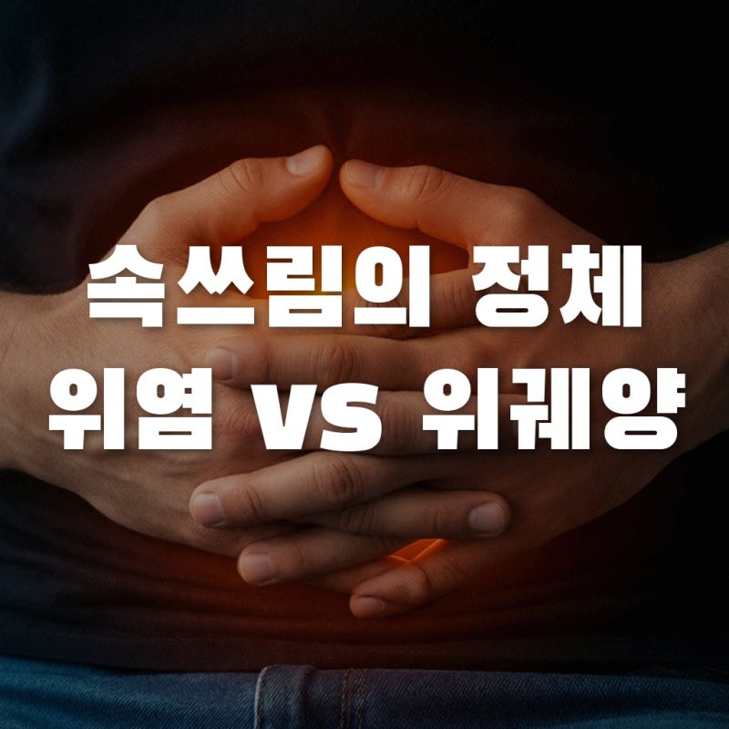 위염위궤양차이 모르면 손해! 속쓰림원인부터 헬리코박터제균치료까지