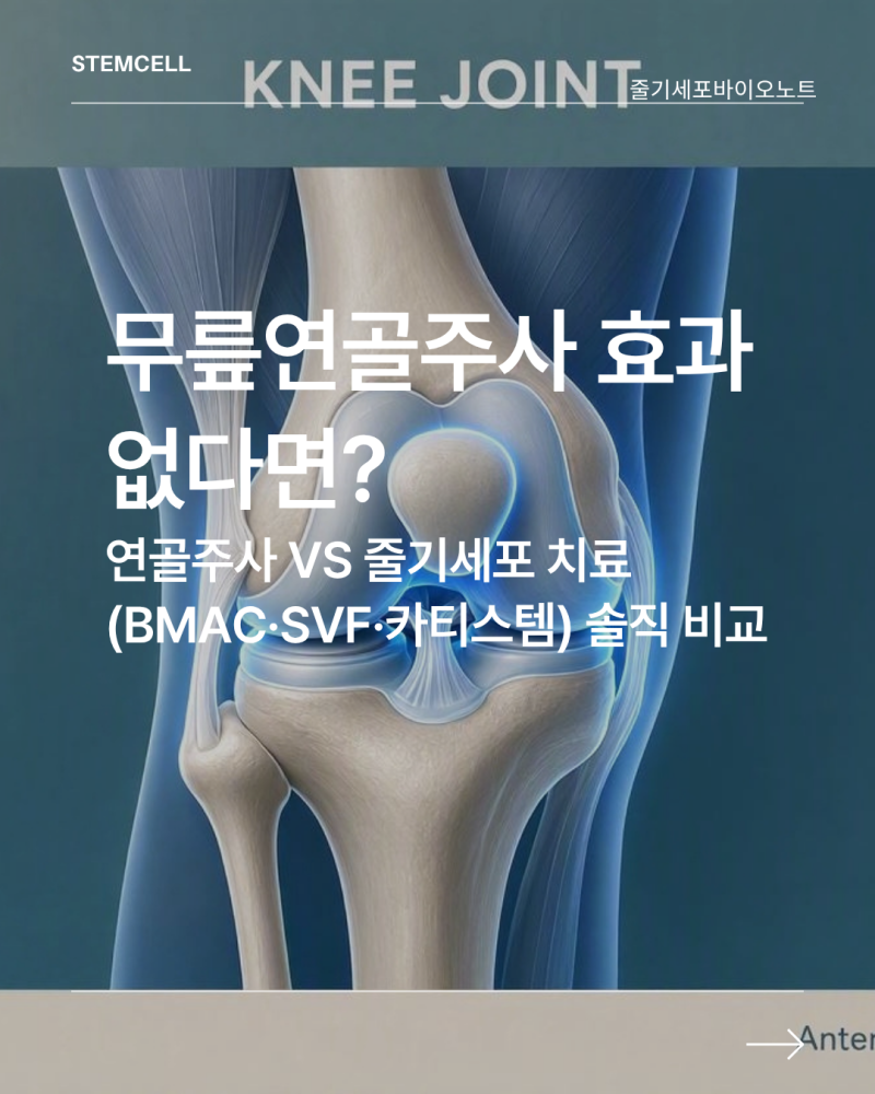 무릎연골주사 효과 없다면? 줄기세포주사(BMAC·SVF) 차이점과 솔직 가격 비교