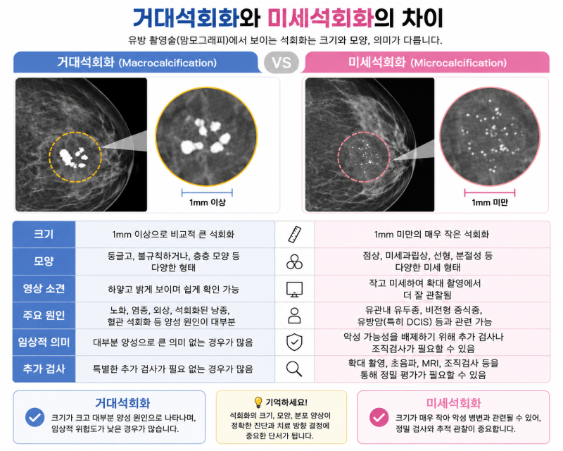 군집성미세석회화, 유방촬영에서 발견됐다면 꼭 알아야 할 것