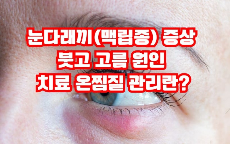 눈다래끼(맥립종) 증상 붓고 고름 원인 온찜질 방법 치료 관리란?