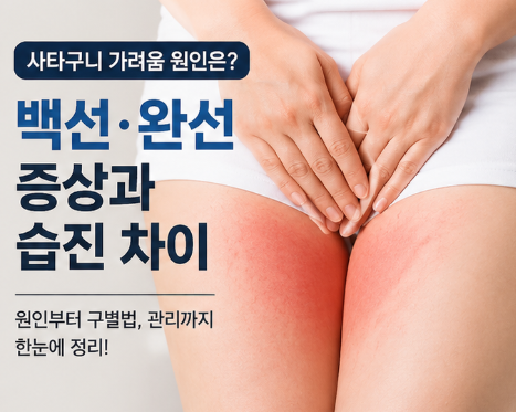 사타구니 가려움 원인은? 백선·완선 증상과 습진 차이