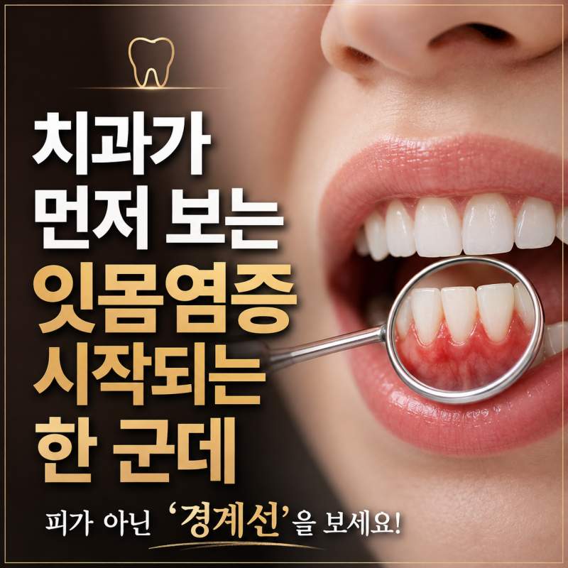 치과가 먼저 보는 자리는 따로, 잇몸염증이 시작되는 곳 한 군데