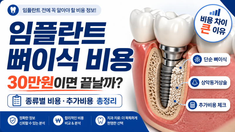“뼈이식 30만원이면 된다던데?” 막상 상담받으면 달라질 수 있습니다