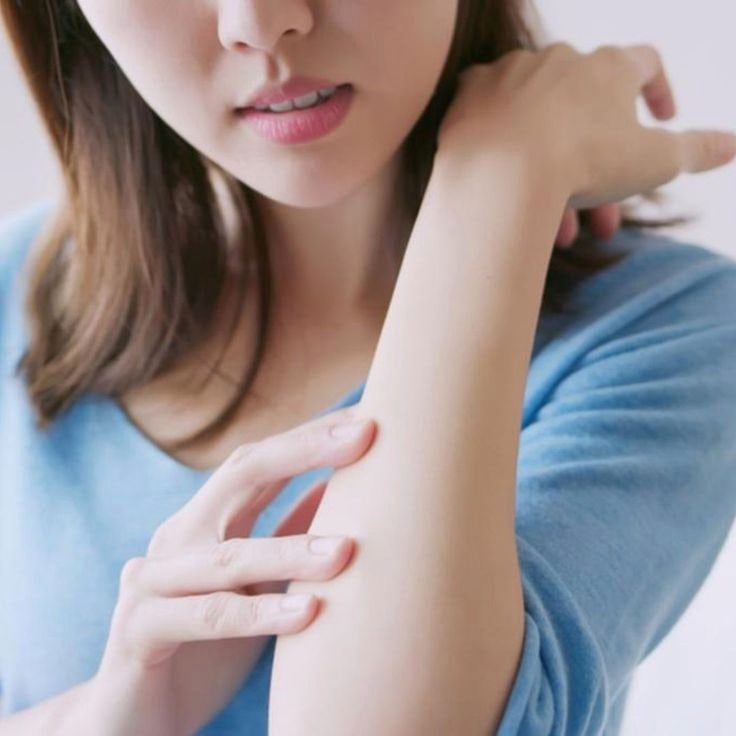 대상포진 증상 물집보다 먼저 나타나는 초기증상